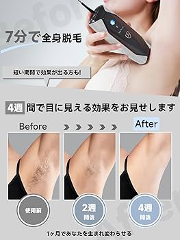 Amazon | JOVS脱毛器 メンズ レディース vio対応 【SGS最優秀